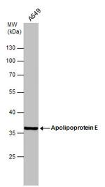 APOE Antibody in Western Blot (WB)