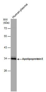 APOE Antibody in Western Blot (WB)