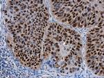 SOX2 Antibody in Immunohistochemistry (Paraffin) (IHC (P))