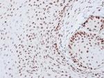 SOX2 Antibody in Immunohistochemistry (Paraffin) (IHC (P))