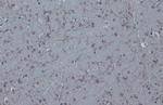 Tyrosine Hydroxylase Antibody in Immunohistochemistry (Paraffin) (IHC (P))