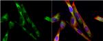 Tyrosine Hydroxylase Antibody in Immunocytochemistry (ICC/IF)