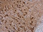 Tyrosine Hydroxylase Antibody in Immunohistochemistry (Paraffin) (IHC (P))