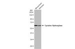 Tyrosine Hydroxylase Antibody in Western Blot (WB)