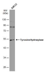 Tyrosine Hydroxylase Antibody in Western Blot (WB)