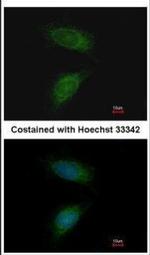 MMP2 Antibody in Immunocytochemistry (ICC/IF)