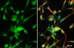 MMP2 Antibody in Immunocytochemistry (ICC/IF)