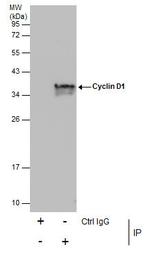 Cyclin D1 Antibody in Immunoprecipitation (IP)