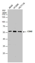 CDK8 Antibody in Western Blot (WB)