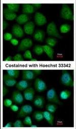 CASK Antibody in Immunocytochemistry (ICC/IF)