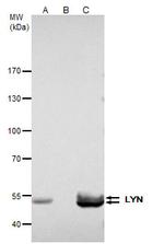 Lyn Antibody in Immunoprecipitation (IP)