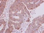 AKT2 Antibody in Immunohistochemistry (Paraffin) (IHC (P))