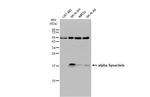 alpha Synuclein Antibody in Western Blot (WB)