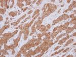 Bcl-10 Antibody in Immunohistochemistry (Paraffin) (IHC (P))