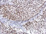 HDAC2 Antibody in Immunohistochemistry (Paraffin) (IHC (P))