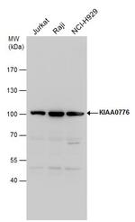 UFL1 Antibody in Western Blot (WB)