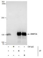 DNMT3A Antibody in Immunoprecipitation (IP)