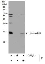 Histone H2B Antibody in Immunoprecipitation (IP)