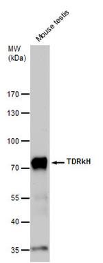 TDRKH Antibody in Western Blot (WB)