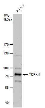 TDRKH Antibody in Western Blot (WB)