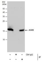 AGR2 Antibody in Immunoprecipitation (IP)