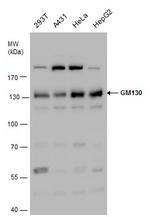 GM130 Antibody in Western Blot (WB)