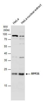 RPP25 Antibody in Western Blot (WB)