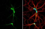 FTO Antibody in Immunocytochemistry (ICC/IF)