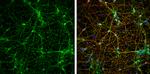 VAMP2 Antibody in Immunocytochemistry (ICC/IF)