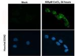 HIF-2 alpha Antibody in Immunocytochemistry (ICC/IF)