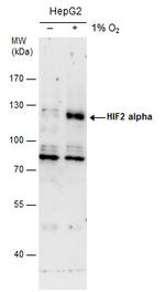 HIF-2 alpha Antibody in Western Blot (WB)