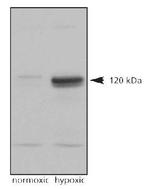 HIF-2 alpha Antibody in Western Blot (WB)