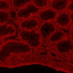 alpha Tubulin Antibody in Immunohistochemistry (Paraffin) (IHC (P))