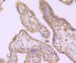 CD61 (Integrin beta 3) Antibody in Immunohistochemistry (Paraffin) (IHC (P))