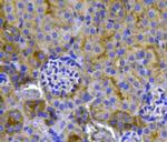 Pan Ras Antibody in Immunohistochemistry (Paraffin) (IHC (P))