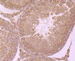 IKK beta Antibody in Immunohistochemistry (Paraffin) (IHC (P))