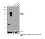 Tyrosinase Antibody in Western Blot (WB)