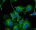 Tyrosinase Antibody in Immunocytochemistry (ICC/IF)