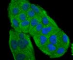 Tyrosinase Antibody in Immunocytochemistry (ICC/IF)