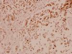 ASK1 Antibody in Immunohistochemistry (Paraffin) (IHC (P))