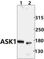 ASK1 Antibody in Western Blot (WB)