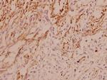 ASK1 Antibody in Immunohistochemistry (Paraffin) (IHC (P))