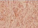 Collagen II Antibody in Immunohistochemistry (Paraffin) (IHC (P))