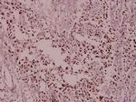 MCM2 Antibody in Immunohistochemistry (Paraffin) (IHC (P))