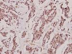 CD122 Antibody in Immunohistochemistry (Paraffin) (IHC (P))