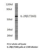 CD122 Antibody in Western Blot (WB)