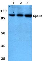 EphB4 Antibody in Western Blot (WB)