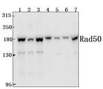 RAD50 Antibody in Immunohistochemistry (Paraffin) (IHC (P))
