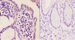 mGluR5 Antibody in Immunohistochemistry (Paraffin) (IHC (P))
