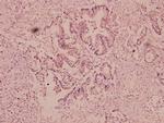 Urokinase Antibody in Immunohistochemistry (Paraffin) (IHC (P))